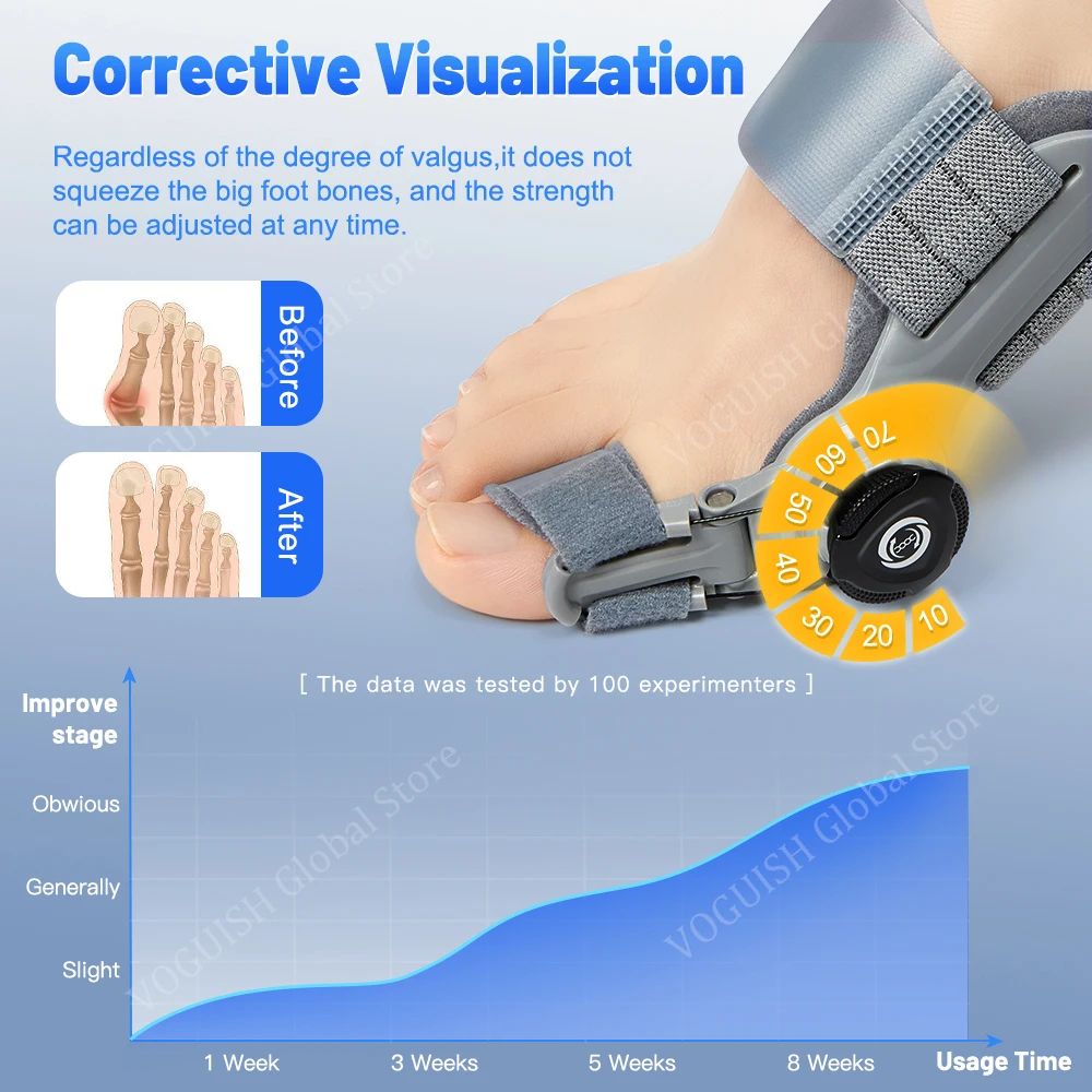 best bunion correctors​- Foot orthosis with adjustable dial on a blue background, showing before and after effects.