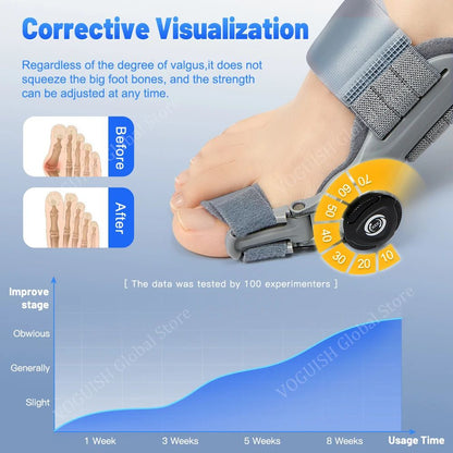 best bunion correctors​- Foot orthosis with adjustable dial on a blue background, showing before and after effects.