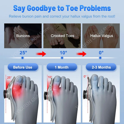 best bunion correctors​- Product advertisement for toe correction device showing before and after effects on bunions, crooked toes, and hallux valgus.
