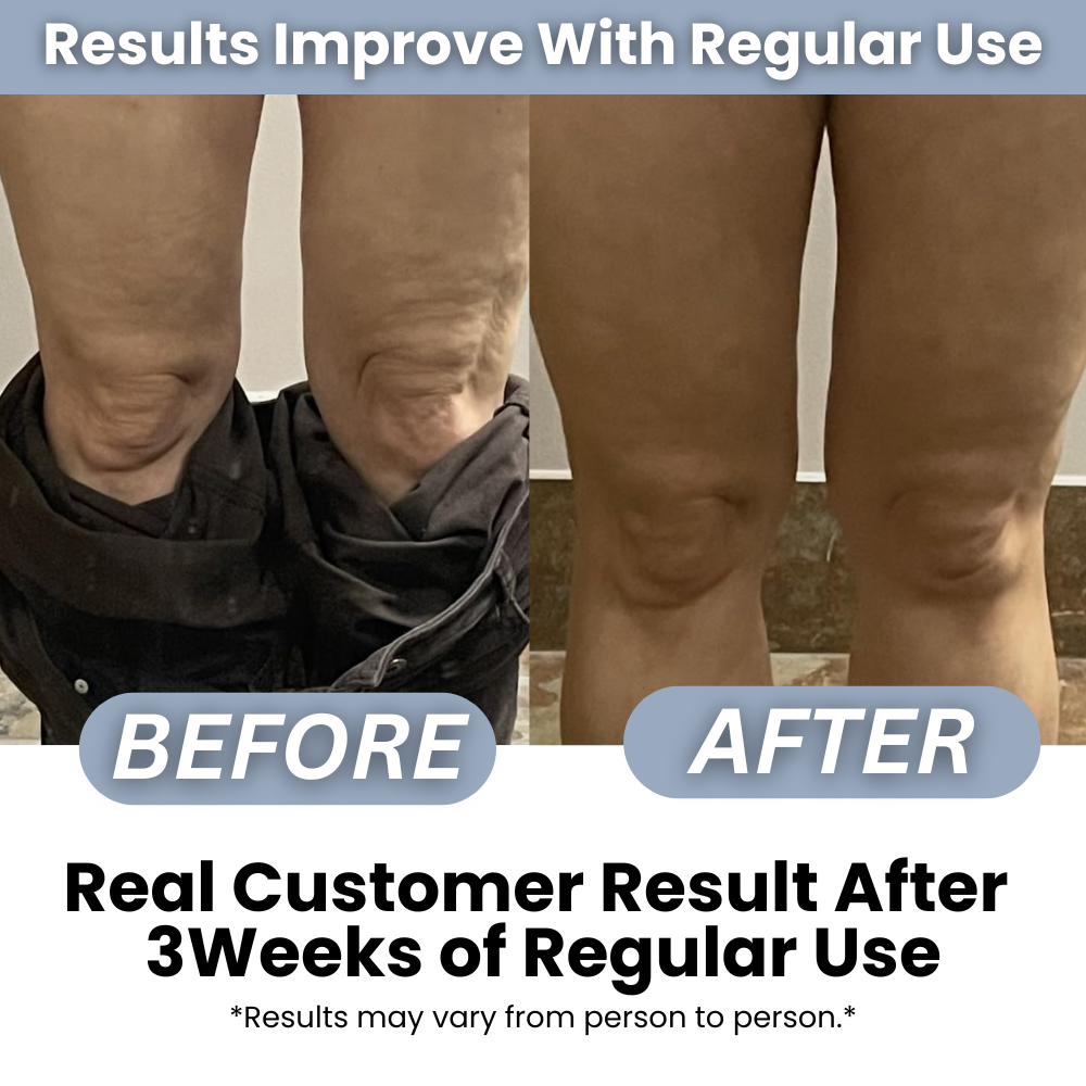 Best Cellulite Massager Roller – Body Slimming, Fat Burning & Muscle Shaping Tool